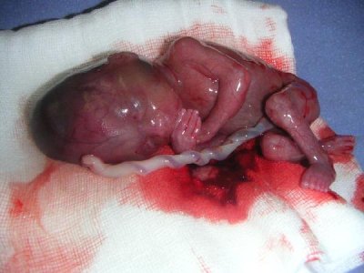 aborto.jpgmid[1].jpg