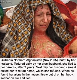 afghanistan-gulbar-burned-by-husband.jpg