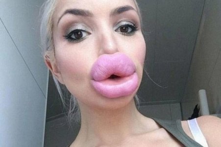 1_PAY-Terrifying-pictures-show-worrying-trend-of-porn-star-lips.jpg