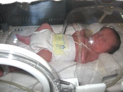 bebe-inkubator.jpg