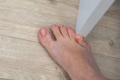 woman-hit-furniture-little-toe-260nw-2125154102.webp