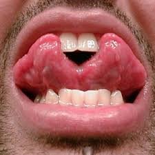 split-tongue-forked-tongue-300x300.jpg